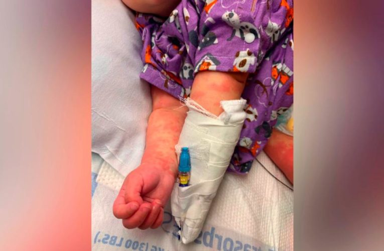 Children who may have multisystem inflammatory syndrome probably need to be hospitalized, doctors say