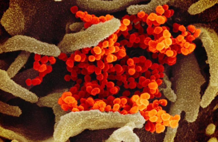 Birx says she wishes America’s shutdown looked like Italy’s