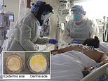 Coronavirus can survive for up to NINE HOURS on human skin, study finds