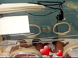 Pregnant Malian woman who was expecting seven babies gives birth to NINE