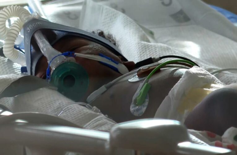 From infants to teens, this hospital has a deluge of young Covid patients. What parents want others to know