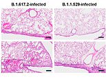 Omicron is less severe than other Covid variants because causes less lung damage, studies suggest