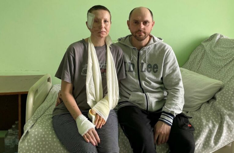 Opinion: A Russian soldier asked how she lost her eye. Here is the awful truth