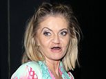 Danniella Westbrook displays the results of her latest nose job