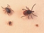 GPs urged to spot the early signs of Lyme disease