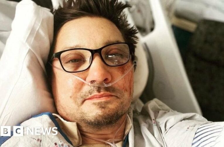 Actor Jeremy Renner broke over 30 bones in snow plough accident